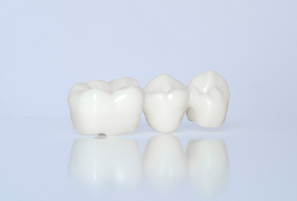 歯のミクロ的表面の特徴分析