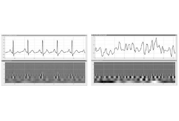 ウェーブレット変換を用いた心電図波形の解析