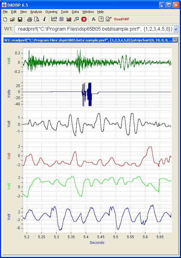 DADiSP/PNRF HBM(R) PNRFインポートモジュール