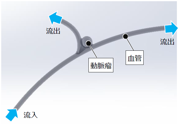 Simcenter FLOEFD ソリューション事例 脳動脈瘤のある血管内の流体解析